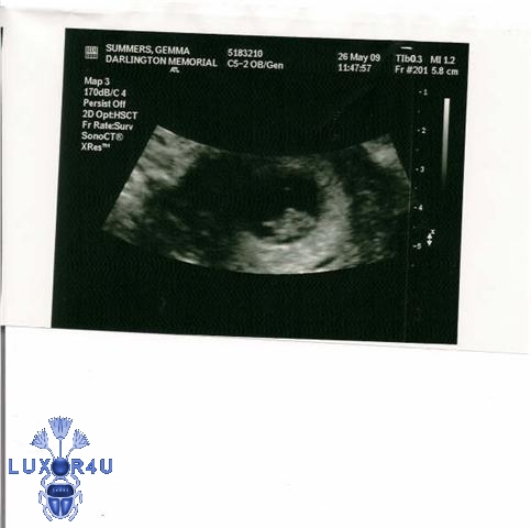 First scan