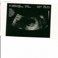 First scan